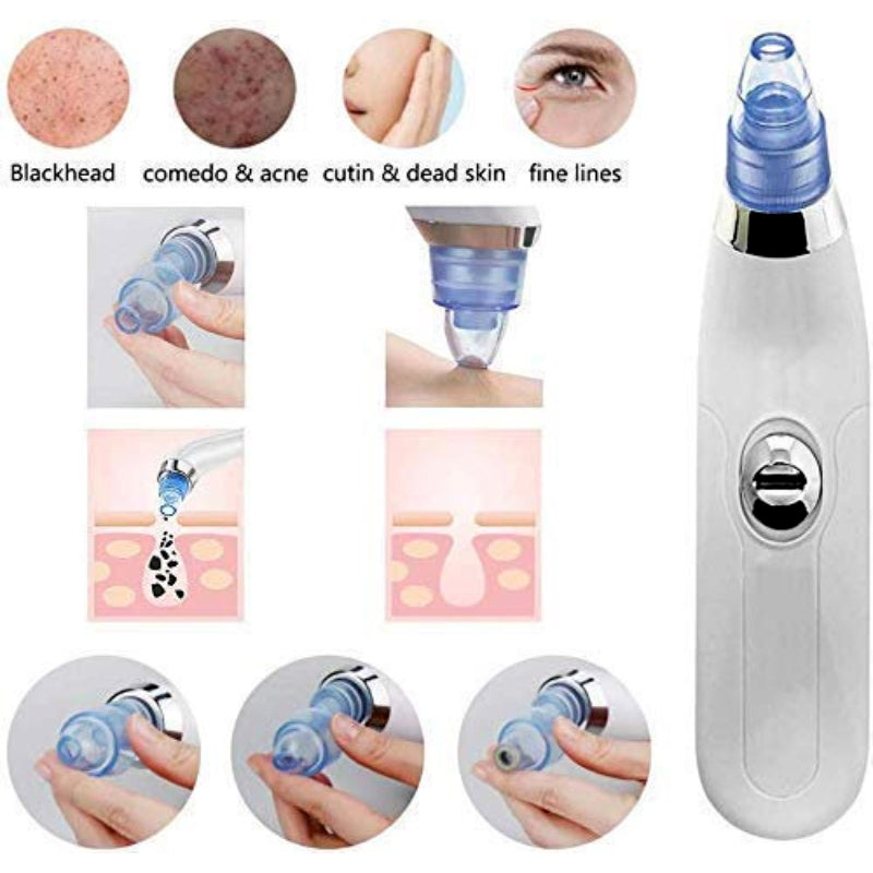 DermaSuction Multifunctional Cleaning Instrument For Pore Acne