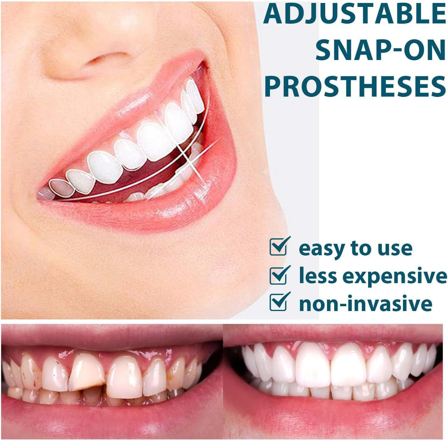Snap On Smile Veneers Moldable False Artificial Braces Teeth Kits For Men And Women
